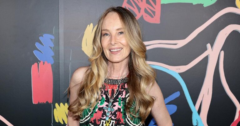Chynna Phillips Says She Will Be Undergoing Surgery to Have a 14 Inch Tumor Removed From Her Leg 214